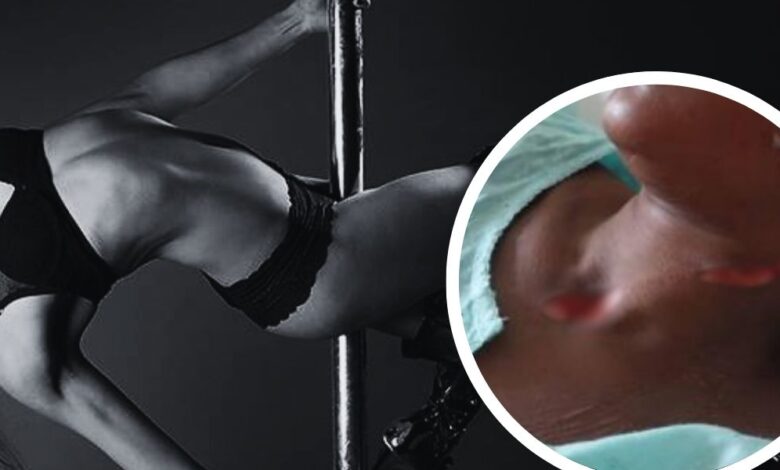 Exotic Dancer's Throat Slashed After Refusing Sex to Have Sex with Customer on pole