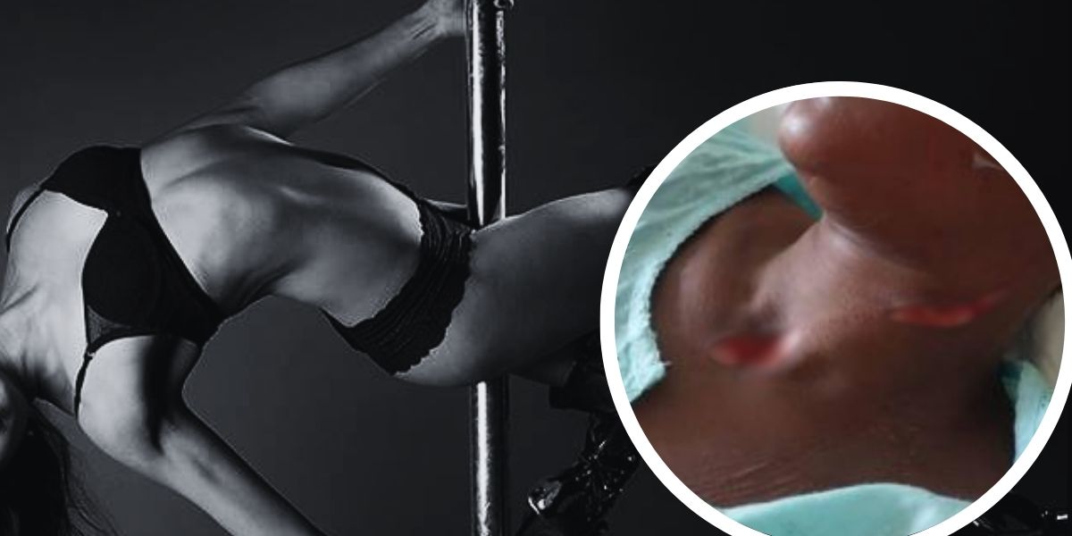 Exotic Dancer's Throat Slashed After Refusing Sex to Have Sex with Customer on pole